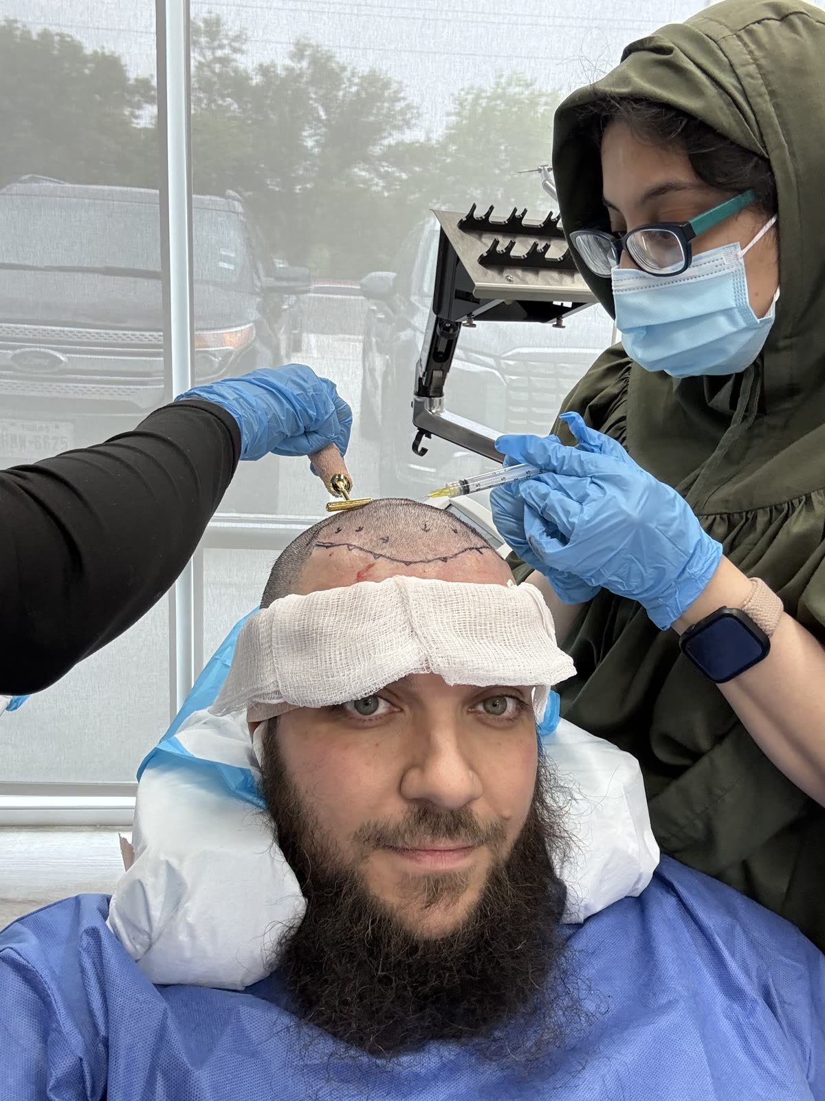 HairBotMD clinical hair restoration procedure with Dr. B and team